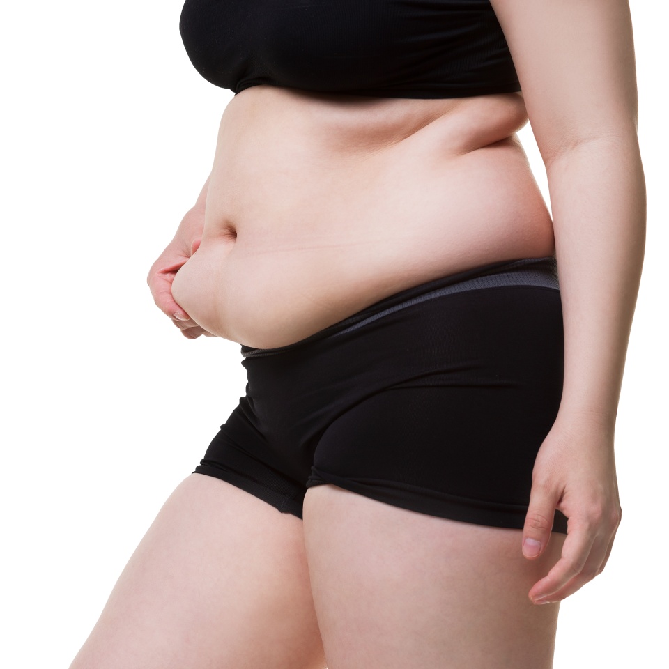 Tummy tuck, flabby skin on a fat belly, plastic surgery concept isolated on white background
